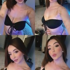 vitiligobabyyy avatar